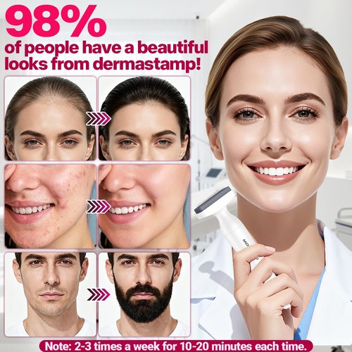 Derma Stamp, MONESAO Microneedling Stamp for Skin Face Hair Scalp Beard, Microneedle Dermastamp Tool with 2 Replacement Heads, Micro Needling Stamp Kit for Women and Men