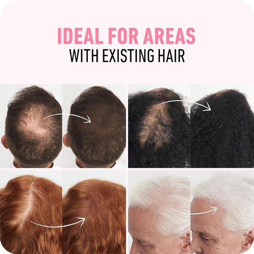 BOLDIFY Hair Fibers - Instantly Thicker & Fuller Hair for Thinning Areas - 28g - Black Shade