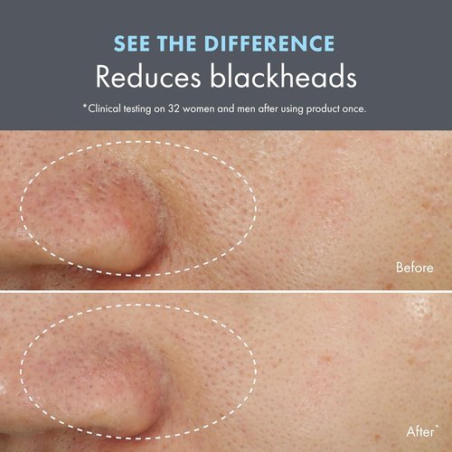 Origins Clear Improvement Face Mask - Blackhead Clearing Scrub with Salicylic Acid & Bamboo Charcoal, 2.5 Fl Oz