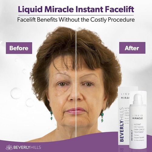 Beverly Hills Instant Facelift Eye Serum - Anti-Aging Treatment for Dark Circles & Puffiness | 30mL (120 Days Supply)