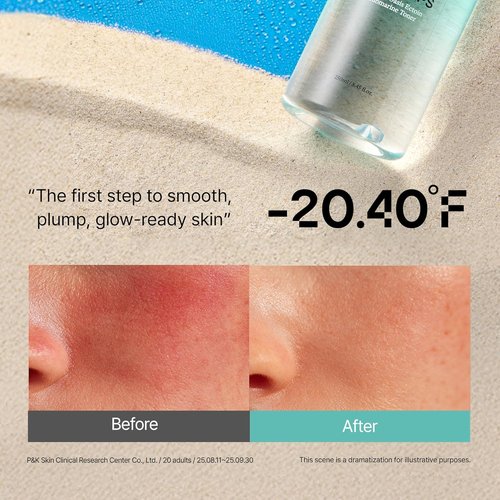 Ectoin Calming Toner by Overlaps - Redness Relief & Barrier Repair for Sensitive Skin | Hydrating Glass Skin with Hyaluronic Acid, 8.45 fl. oz.