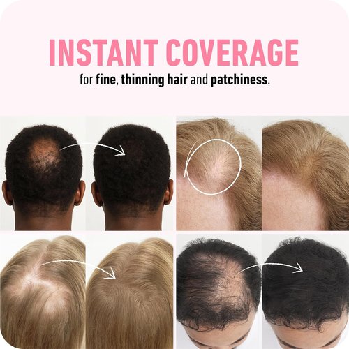 BOLDIFY Hair Fibers - Instantly Thicker & Fuller Hair for Thinning Areas - 28g - Black Shade