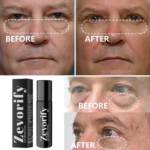 Skiennix Eye Repair Stick for Men - Caffeine Under Eye Roller for Dark Circles & Puffiness, 0.34 Fl Oz