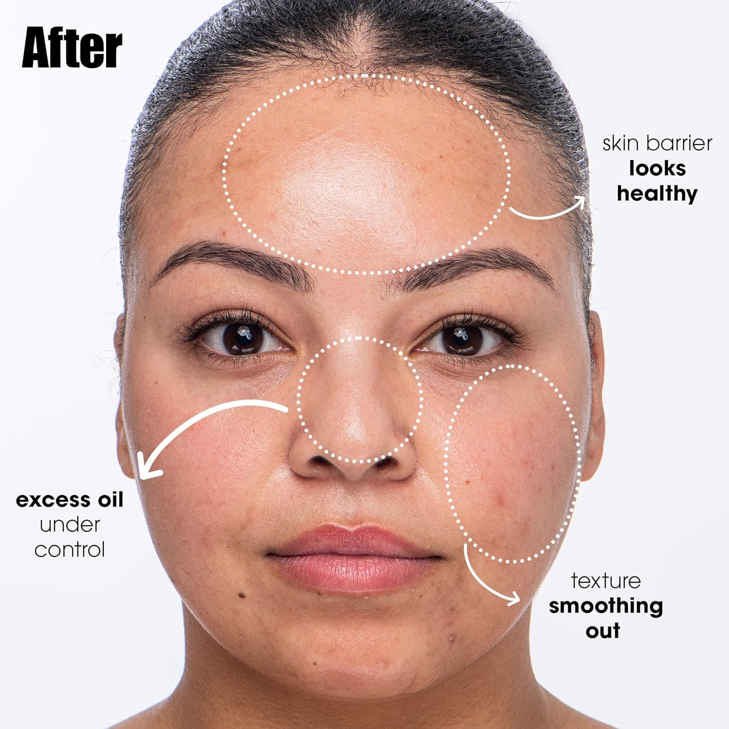 Sunday Riley Salicylic Acid Cleanser - Breakout Breakup Formula for Blemish-Prone Skin