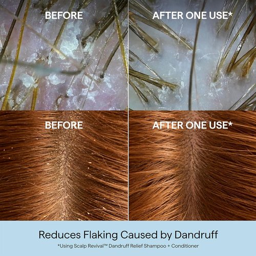 Briogeo Scalp Revival Conditioner - Dandruff Relief with Charcoal & Salicylic Acid | Color-Safe, Vegan | 8.4 fl oz