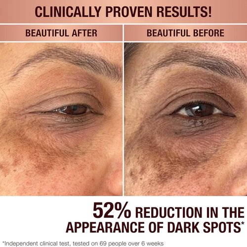 Charlotte Tilbury Radiance Recovery Serum - Tranexamic Acid & Vitamin C for Brighter Under Eyes | Reduces Dark Spots & Redness
