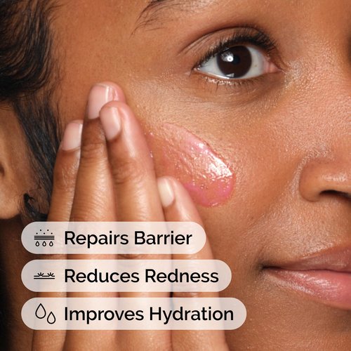The Ordinary Soothing & Barrier Support Serum, Redness-Reducing & Hydrating Solution for Skin Barrier Recovery, 1 Fl Oz (Pack of 2)
