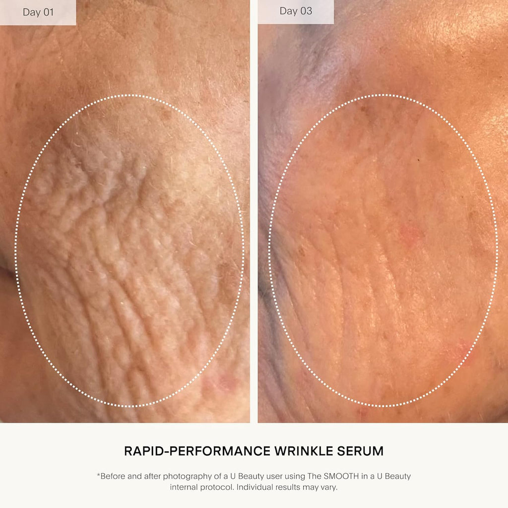 U Beauty The Smooth Dynamic Wrinkle Defense Serum - Multi-Peptide Complex & Retinol for Firming, 15ml