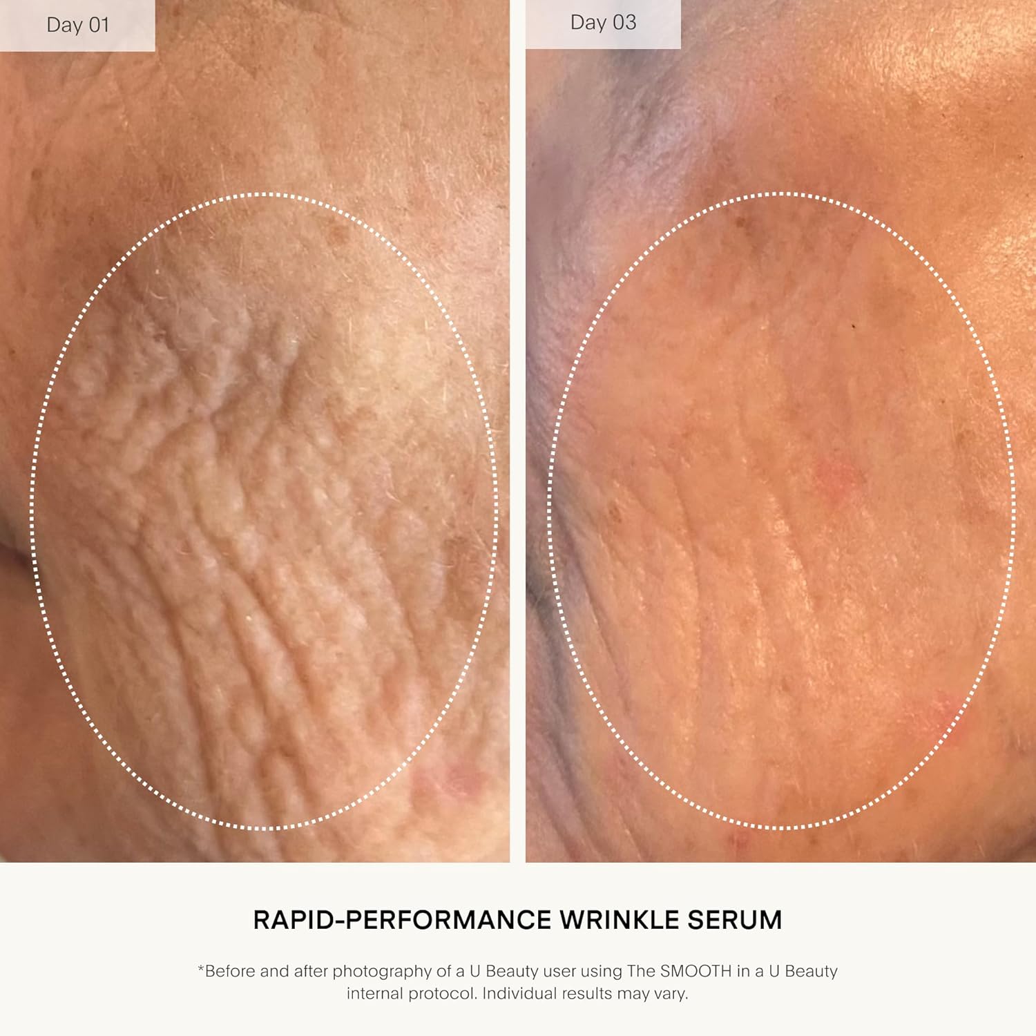 U Beauty The Smooth Dynamic Wrinkle Defense Serum - Multi-Peptide Complex & Retinol for Firming, 15ml