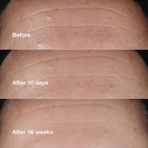 Clinique Smart Clinical Repair Anti-Aging Face Serum - Hydrating Formula with Hyaluronic Acid & Peptides for All Skin Types