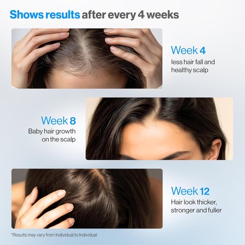 Be Bodywise Rosemary Hair Growth Serum - 3% Rosemary & Redensyl | DHT-Blocking Roll-On for Hair Fall | 50 ml | Paraben/Sulfate-Free