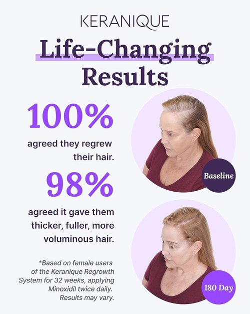 Keranique Hair Regrowth Treatment for Women - 2% Minoxidil Topical Solution for Thicker Hair - 2 Fl Oz