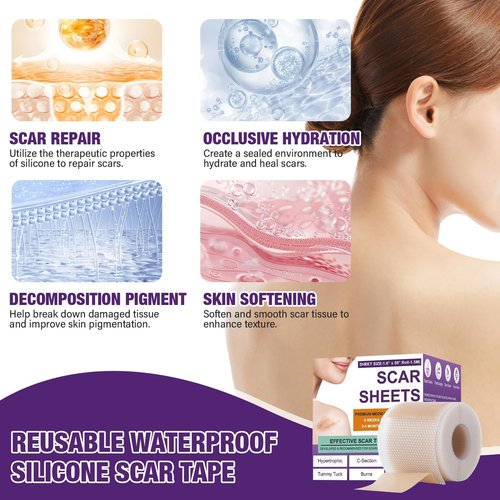 Silicone Scar Sheets,Silicone Scar Tape,Silicone Scar Removal Strips for Surgical,C-Section,Tummy Tuck,Keloid Scars (1.6"X 157" Roll-4M) Keloid Bump Removal
