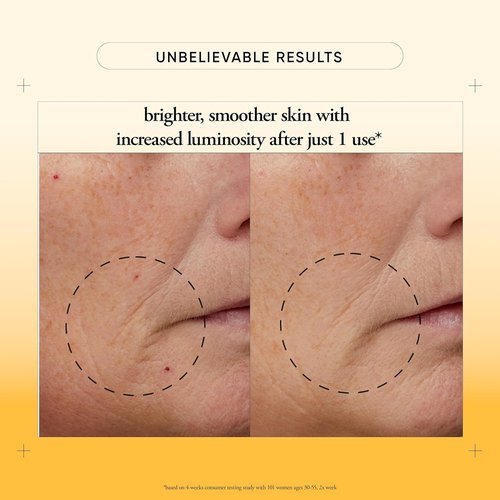 Philosophy Microdelivery Vitamin C Resurfacing Peel Kit - Two-Step Treatment for Smooth Skin Texture & Even Tone