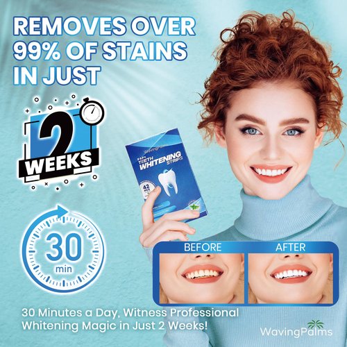Professional Whitening Strips for Sensitive Teeth:Hydrogen Peroxide-Free Treatments - Effective & Gentle Dental Whitener (42 Count (Pack of 1), Mint)
