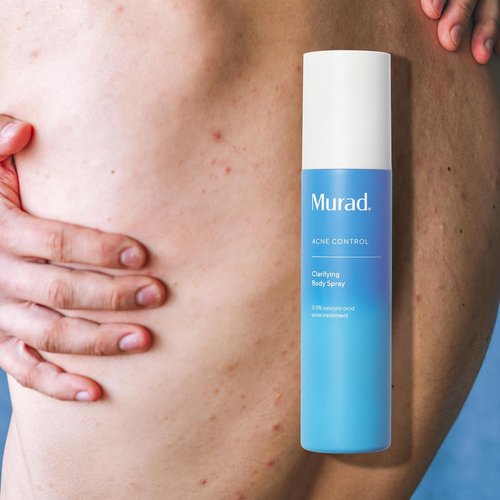 Murad Clarifying Body Spray - Salicylic Acid Treatment for Bacne & Body Acne, 6.0 oz