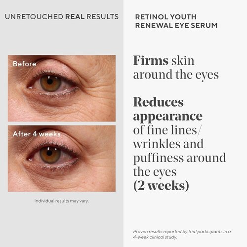 Murad Retinol Youth Renewal Serum Combo - Anti-Aging Face & Eye Serum for Dark Circles & Puffiness | Set of 2