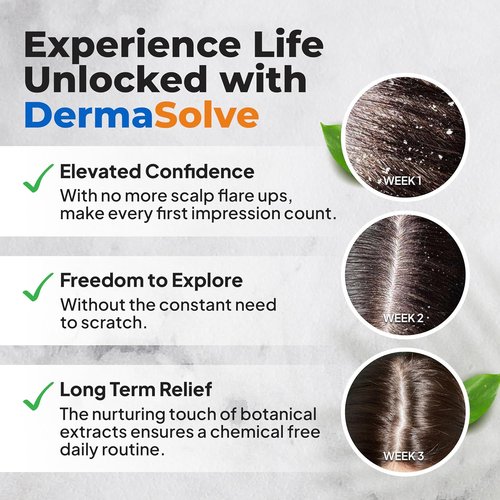 Dermasolve Scalp Oil - Flaky Scalp Relief for Psoriasis & Dandruff - 4 oz Dermatologist Approved