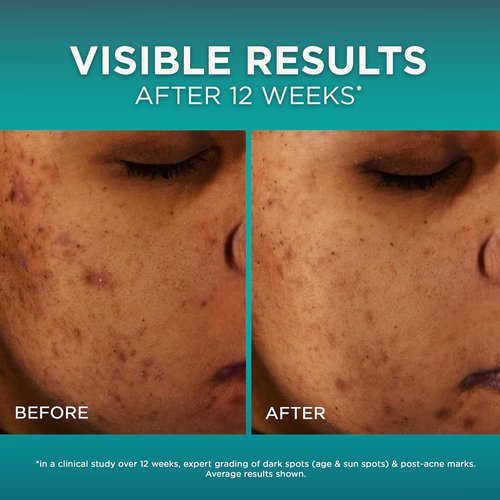 L’Oréal Paris Bright Reveal Dark Spot Serum - 12% Niacinamide & Amino Sulfonic - 1oz + Free Moisturizer Sample