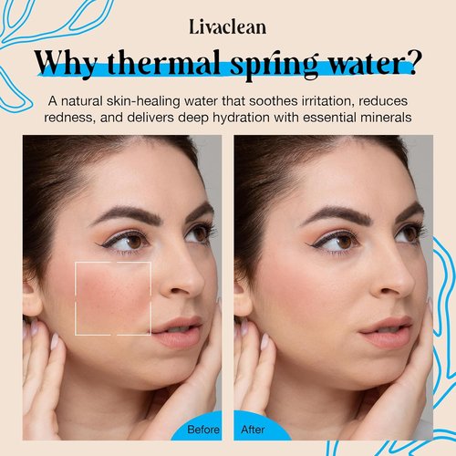 Thermal Spring Water Face Spray Mist by [Brand Name] - Hydrating with Hyaluronic Acid & Aloe Vera | 300ml + 50ml