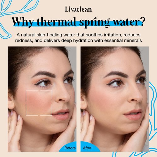 300ml + 50ml Thermal Spring Water Face Spray Mist Hydrating w/ Hyaluronic Acid & Aloe Vera - Hydrating Face Mist, Soothing & Calming, Mineral-Rich Skin Nourishment, Refreshing, 10 fl oz + 1.7 fl oz