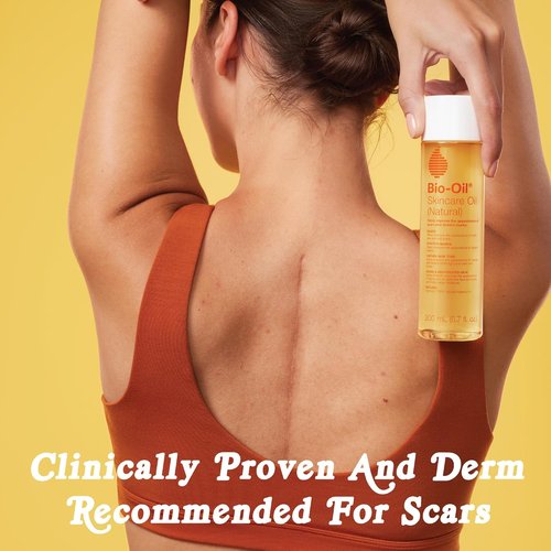 Bio-Oil Natural Skincare Oil - Serum for Scars & Stretch Marks | Moisturizer for All Skin Types, 6.7 Oz