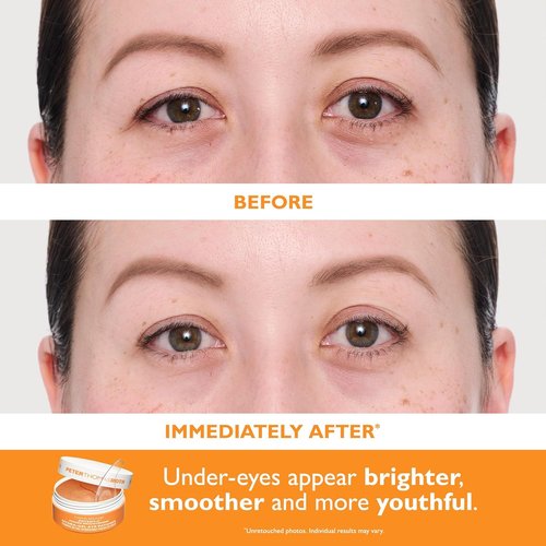 Peter Thomas Roth | Vitamin C & Hyaluronic Eye Patches - Full-Size 2-Piece Kit for Brightening & Hydration