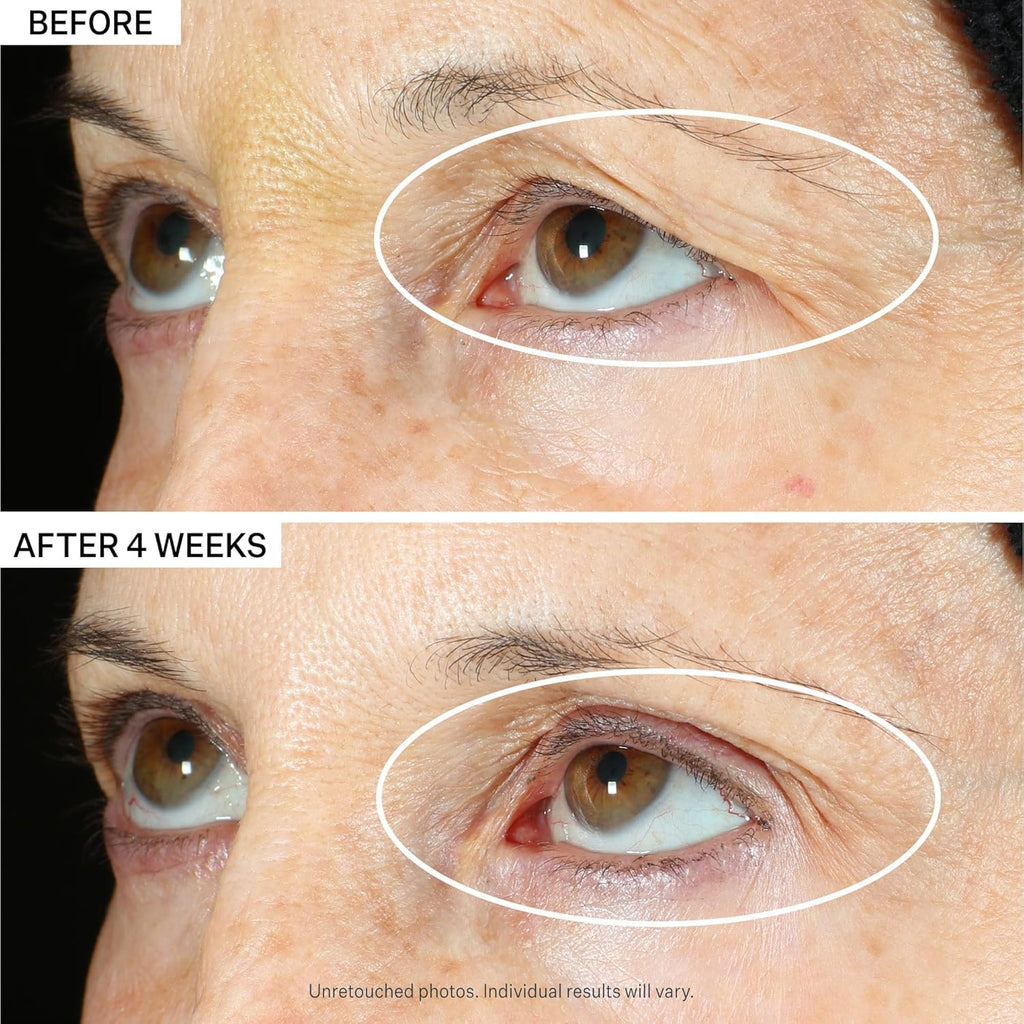 StriVectin Eye Serum & Neck Cream Duo - Tighten & Lift with Alpha-3 Peptides™ | 360° Care for Eyes & Neck