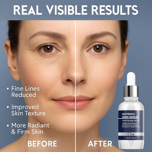 Matrixyl 3000 Serum - Anti-Wrinkle & Collagen Boosting with Hyaluronic Acid | 30ml Deep Hydration & Firming
