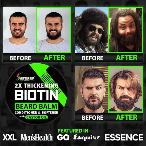 Skiennix Beard Growth Kit - 2X Thickening Biotin Balm & Conditioner + 6X Liquid Biotin with Collagen Peptides for Enhanced Beard & Hair Growth