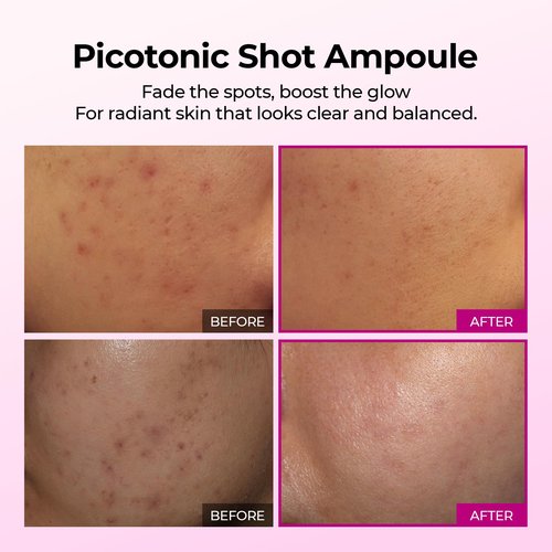 Dr.Melaxin Cemenrete Picotonic Shot Calcium Serum for Firming Density collagen serum Even Skin Tone & Skin Clarity Anti-aging Dark spot care 1.01 fl.oz.