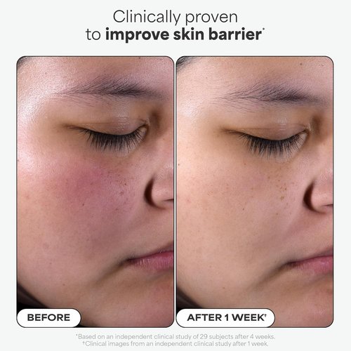 Paula's Choice SKIN PERFECTING 2% BHA Exfoliating Pads - Clear Blackheads & Minimize Pores