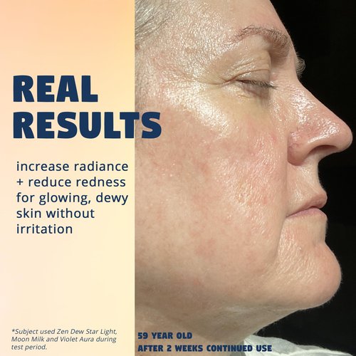 Clinically Advanced Korean Snail Mucin Serum - Star Light by Zen Dew (3.38 oz) Brightening, Anti-Aging & Hydrating K Beauty Face Serum for Glass Skin Glow – Smoothing Korean Skin Care