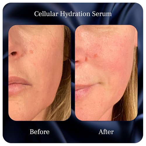 Skiennix Cellular Hydration Serum - Hyaluronic Acid Alternative for Deep Hydration - 1 Fl Oz