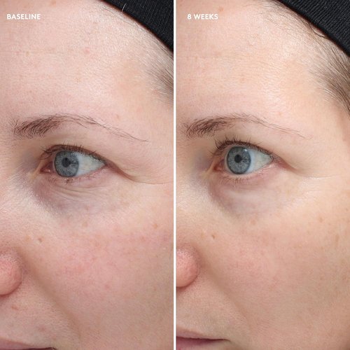 Colorescience Total Eye Firm & Repair Cream - Anti-Aging Formula | 0.6 Fl. Oz.