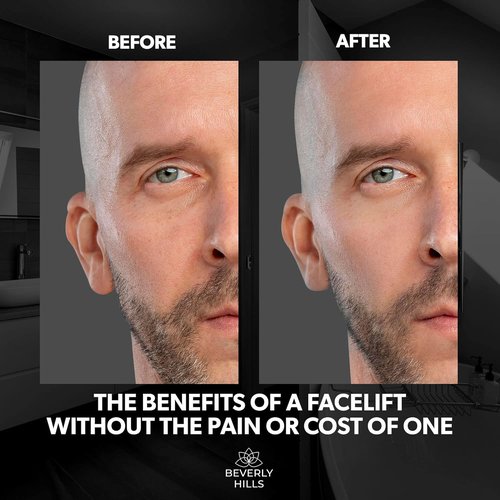 Beverly Hills Men's Instant Facelift Eye Serum - Reduces Dark Circles & Puffy Eyes | Anti-Wrinkle Treatment