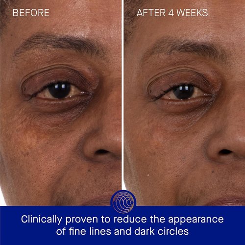 Augustinus Bader Eye Patches - Luxury Hydrating Anti-Aging Treatment for Puffiness & Dark Circles - Soothing Formula