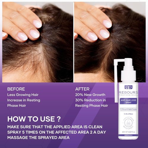 Hair Regrowth Treatment by Hair Regrowth | 5% Procapil Anti Hair Loss Spray for Stronger, Fuller Hair – Residue-Free Formula – 1 Pack