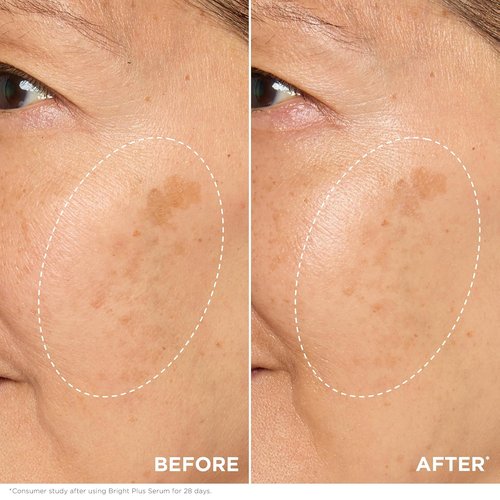 Clarins Bright Plus Serum - Boost Radiance & Even Skin Tone | Targets Dark Spots | 1 Fl Oz