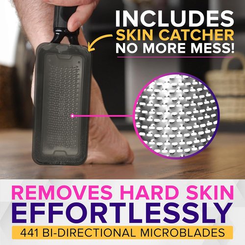 NYK1 Megafile Foot Callus Remover - Rustproof XL Size with Skin Catcher | High-Performance Wet & Dry Use Scrubber