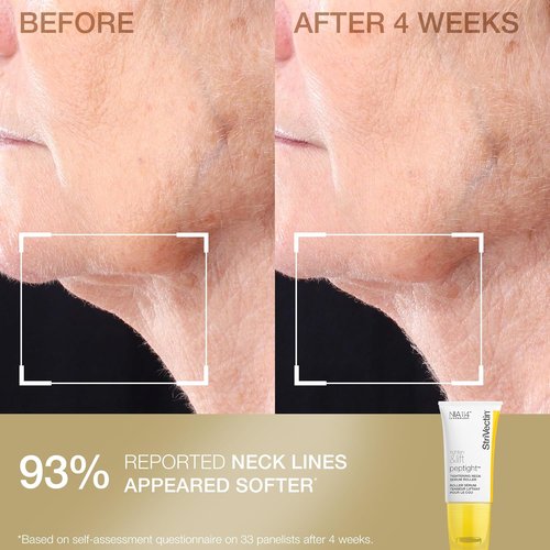StriVectin Neck Cream & Serum Roller Set - Anti-Aging Formula for Smoother Skin & Reduced Wrinkles