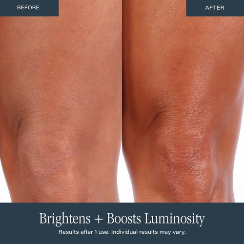 SKINN Anti-Aging Luminous Body Butter for Dry Skin - Long Lasting Ultra Moisturizing Cream for Dryness, Dullness & Rough Skin Texture - Quick-Absorbing & Non-Greasy with Vitamin C & Manuka Honey
