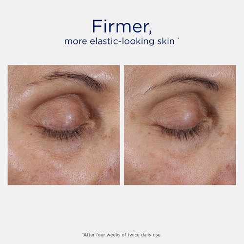 NEOSTRATA Skin Active Intensive Eye Therapy - Anti-Aging Under Eye Cream for Dark Circles & Puffiness | 0.5 oz