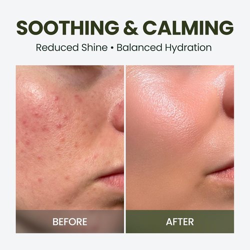 HyCicaMue Defence Cream - Soothing Barrier Repair Moisturizer with Cica & Hyaluronic Acid | Vegan Formula for Sensitive Skin, Hydration Boost