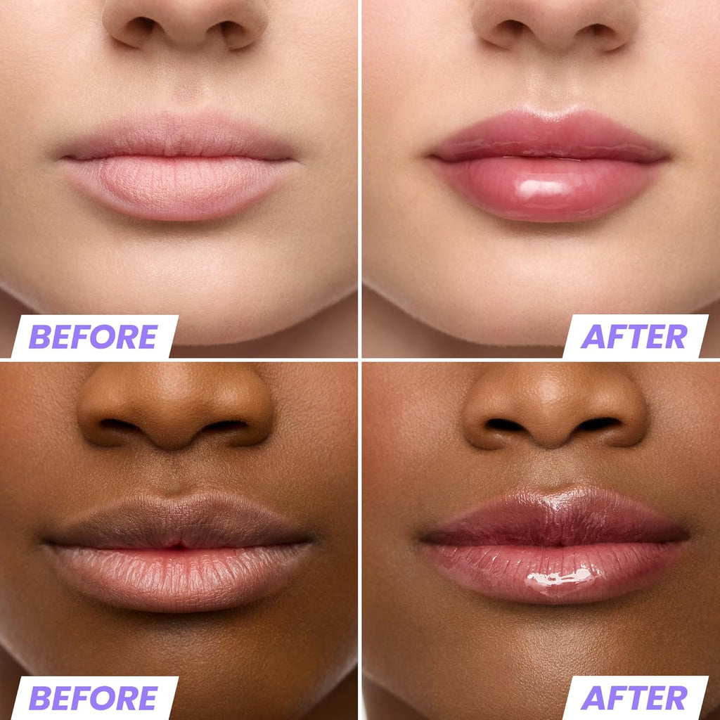 Wonderskin Lip Oil Rehab Serum - Hydrating Tinted Lip Oil for Dry Lips | Non-Sticky Deep Red Tint (Honey)