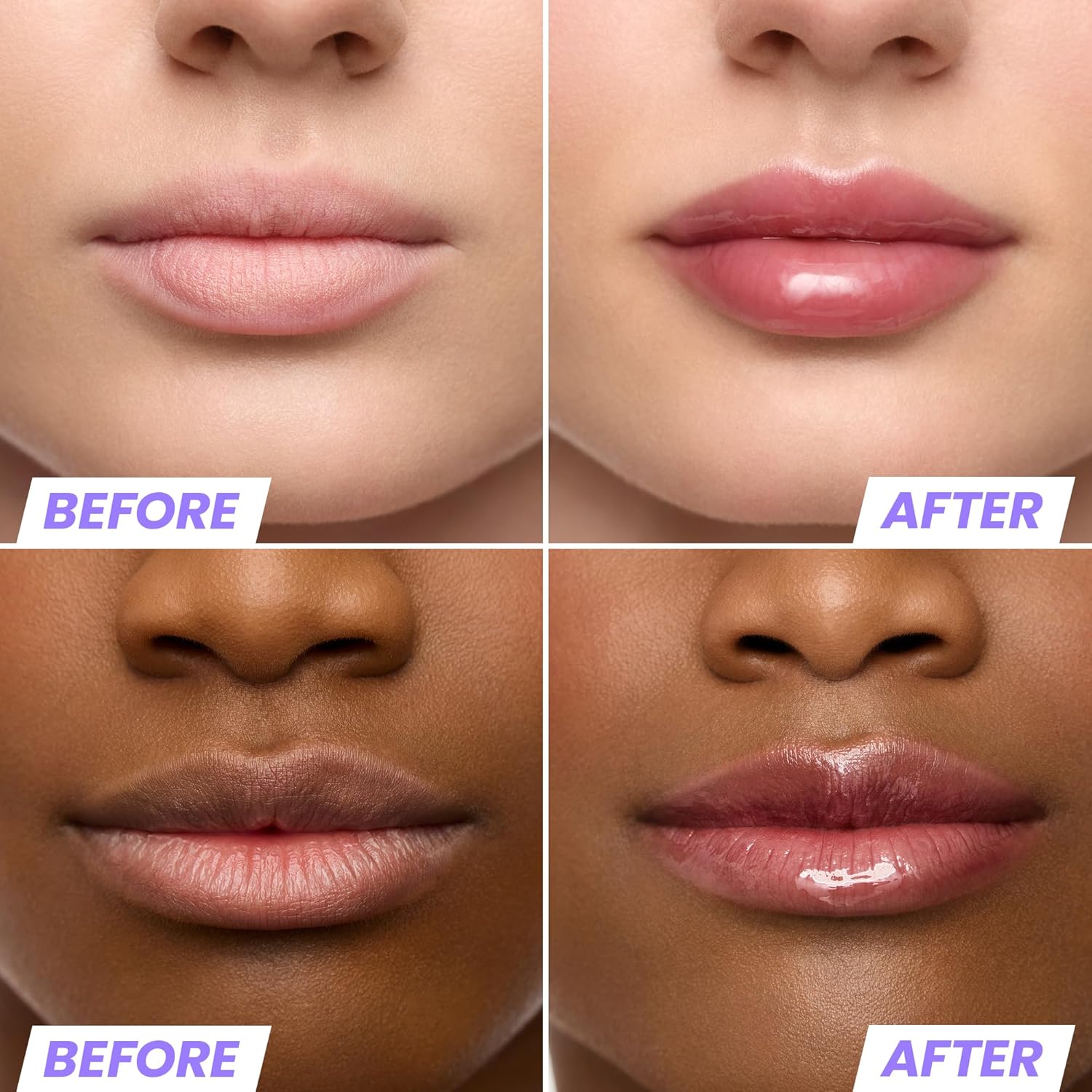 Wonderskin Lip Oil Rehab Serum - Hydrating Tinted Lip Oil for Dry Lips | Non-Sticky Deep Red Tint (Honey)