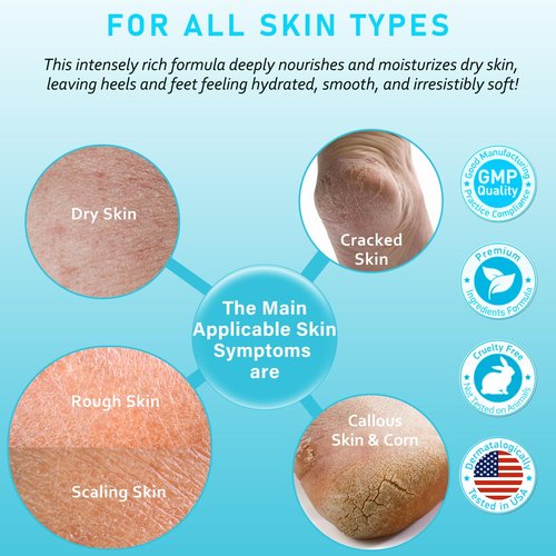 Urea Cream 40% Maximum Strength with Vitamin E & Salicylic Acid - Foot Cream for Winter Dry Cracked Heels - Intense Moisturizer for Hands, Feet & Body - Callus Remover - Lightweight Non-Greasy Formula