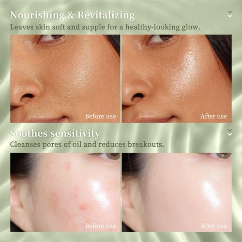 Grospe Organic Aloe Vera Gel Stick for Face & Body, Pure Aloe Gel Ideal for Hydrating, Soothing for Dry Skin, Anti-Wrinkle, Acne Scars, Soothing After Sun Care Relief