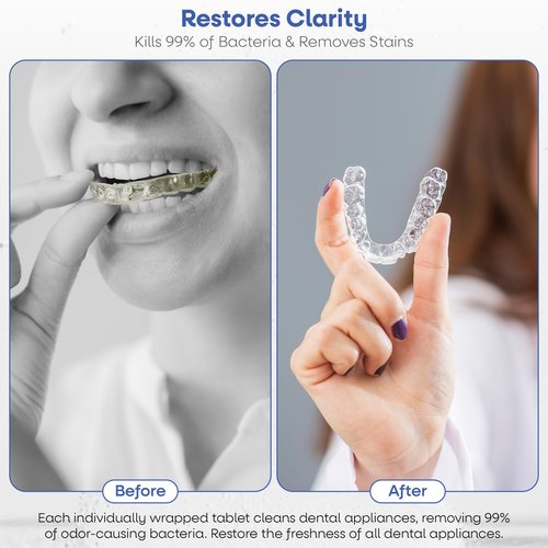 Dr. Taylor’s Denture and Retainer Cleaner Tablets (120 count) Effectively Removes Stains, Plaque, and Odor - Sports guards, Night Guards, Clear Aligners & Dentures Refreshing Mint Flavor