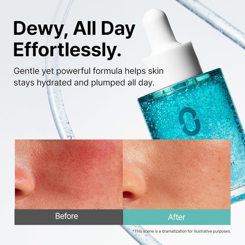 Ectoin Redness Soothing Serum - Lightweight Hydration for Blemish-Prone Skin | 8-Layer Hyaluronic Acid & Peptides | Korean Skincare, 1.01 fl. oz.